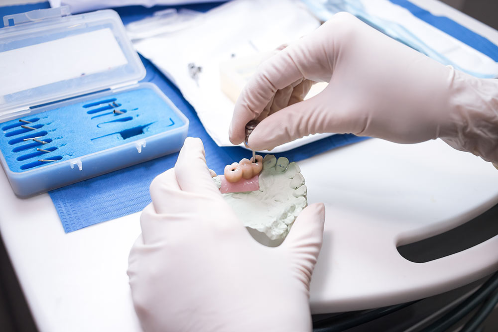 Clase Uno Marketing Dental, fotografía para clinicas dentales